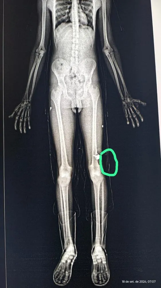 Reprodu&ccedil;&atilde;o / Seap