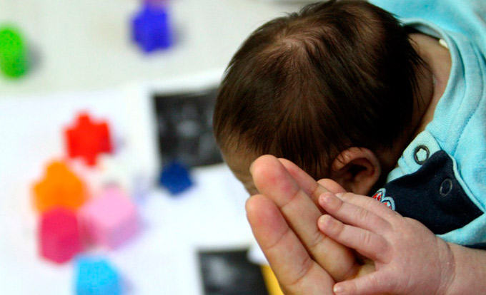 Vírus bovino é encontrado em tecidos de bebês com microcefalia