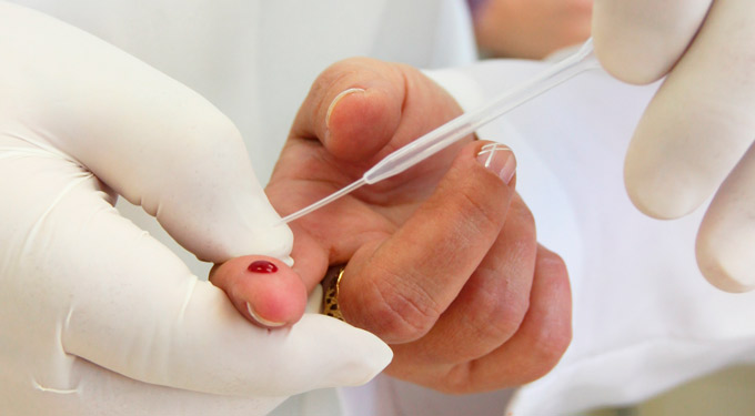 ONU alerta para risco de nova epidemia de Aids