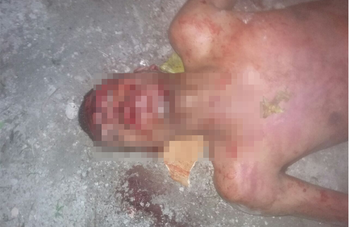 Jovem morre após ser espancado em via pública