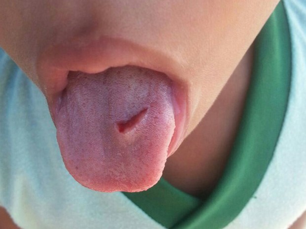 Professora corta língua de criança como castigo em creche