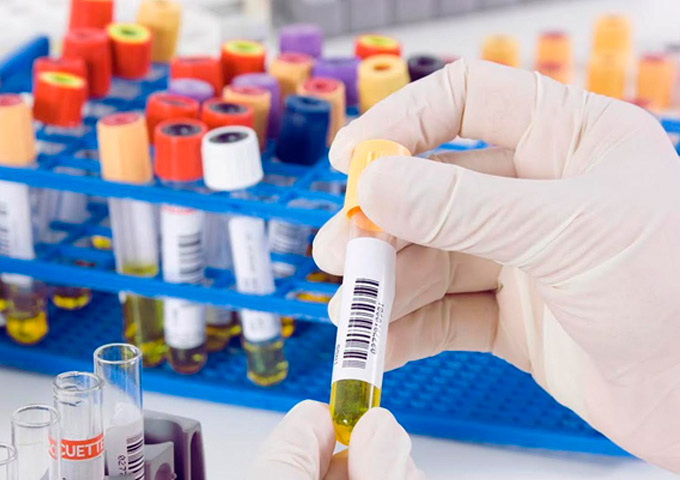 Diagnóstico para zika e dengue terá resultado em 2 horas