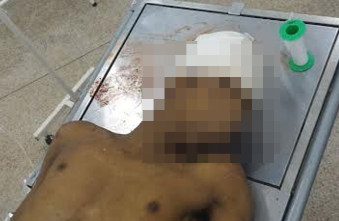 Jovem morre após ser baleado e agredido com pedradas 