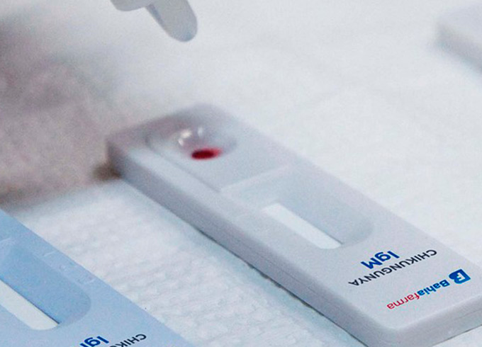 Anvisa libera teste rápido de chikungunya desenvolvido na BA