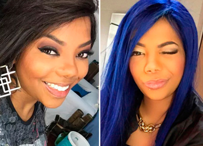 Ludmilla nega novas cirurgias no corpo depois de plástica no nariz