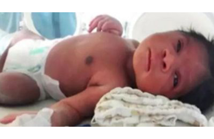 Tem alta bebê encontrado em saco de lixo com turista estrangeiro