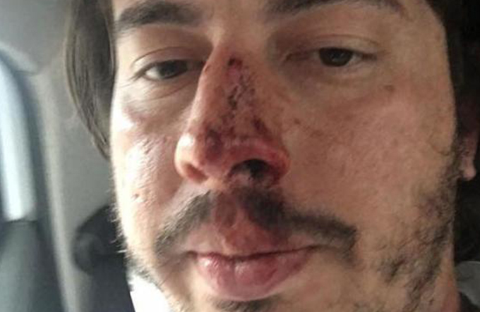 Guarda municipal é afastado das atividades após agressão