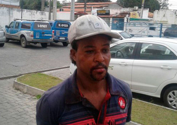 Homem é preso acusado de jogar soda cáustica em companheira 
