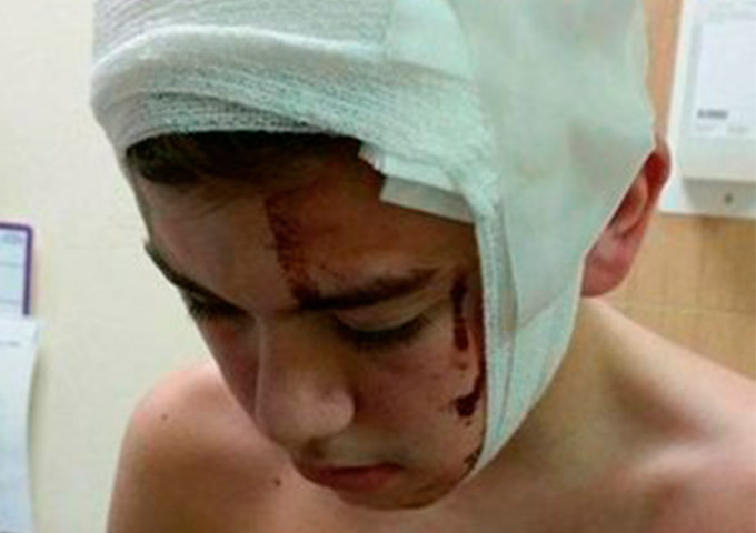 Jovem de 17 anos é atacado por palhaço sinistro
