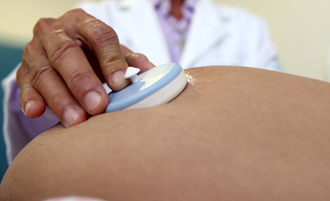 Zika aumenta chance de aborto no início da gravidez