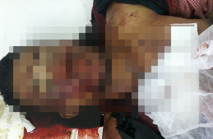Jovem é assassinado a tiros no Entroncamento