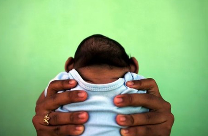 Governo declara fim da situação de emergência por zika e microcefalia