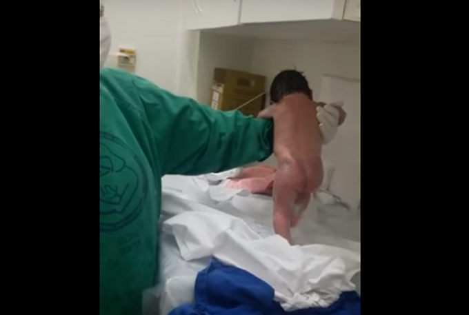 Vídeo com bebê caminhando logo após nascer viraliza; entenda
