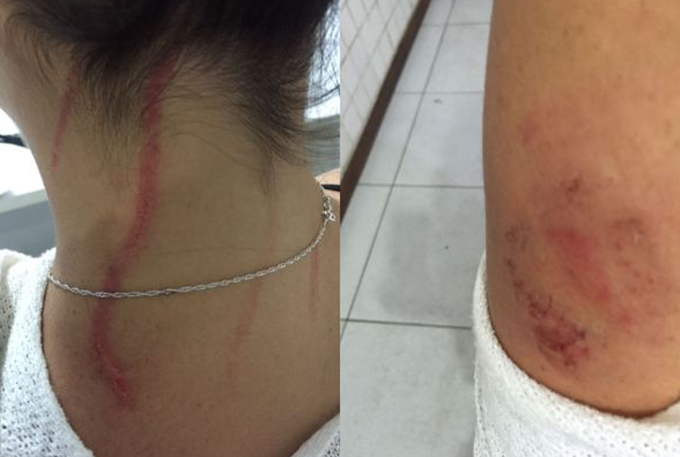 Repórter e cinegrafista são agredidos durante reportagem 