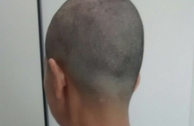 Mulher é espancada e tem cabelo raspado pelo marido 