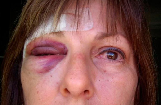 Professora afirma que foi agredida por aluno de 15 anos