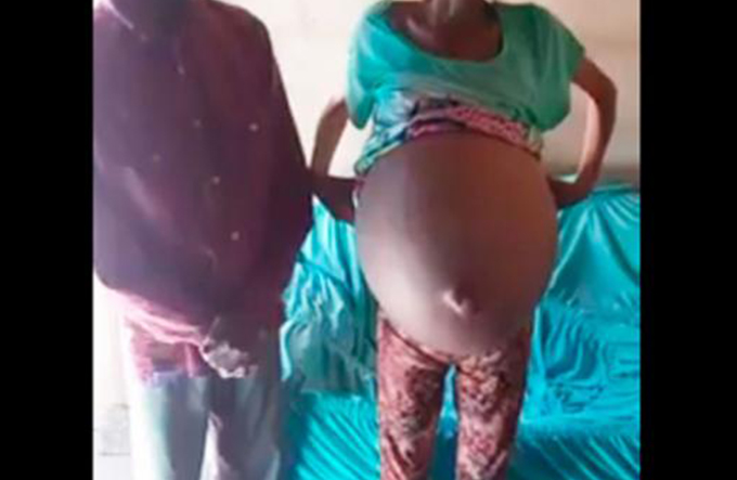 Mulher com barriga gigante passa por especialista após vídeo viralizar