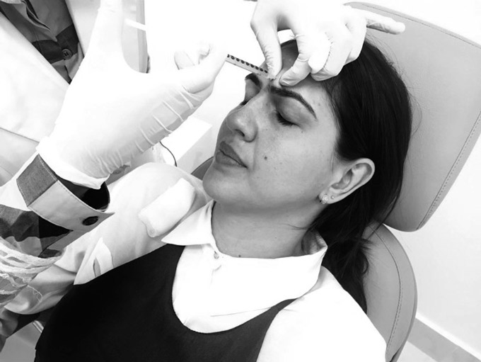 Justiça proíbe dentistas de aplicar botox em pacientes