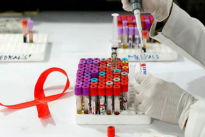 Crianças portadoras do HIV terão novo medicamento 