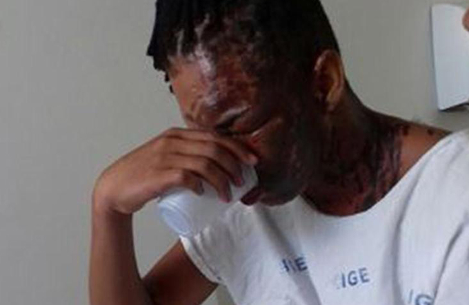 Homem agride ex-mulher e família com soda cáustica