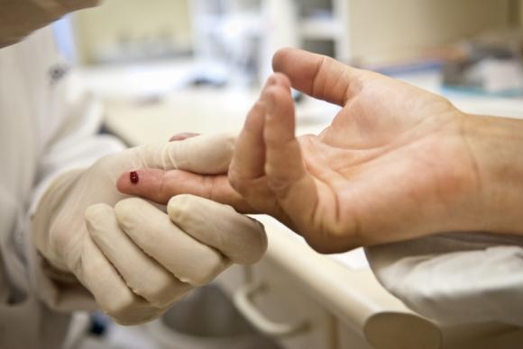 SUS vai oferecer remédio que previne contaminação pelo vírus HIV este mês