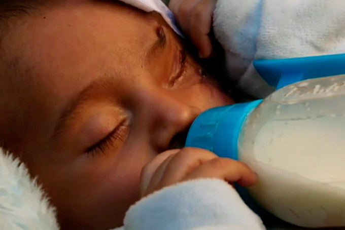 Bebê de 3 meses perdeu olho em bombardeio na Síria