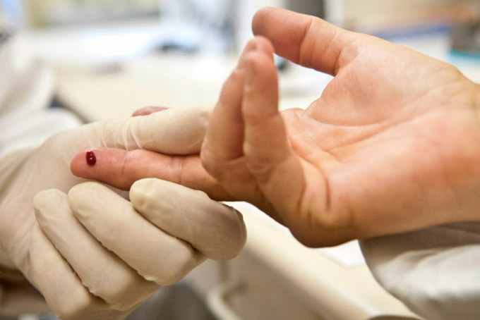 SUS oferece tratamento completo a portadores de HIV