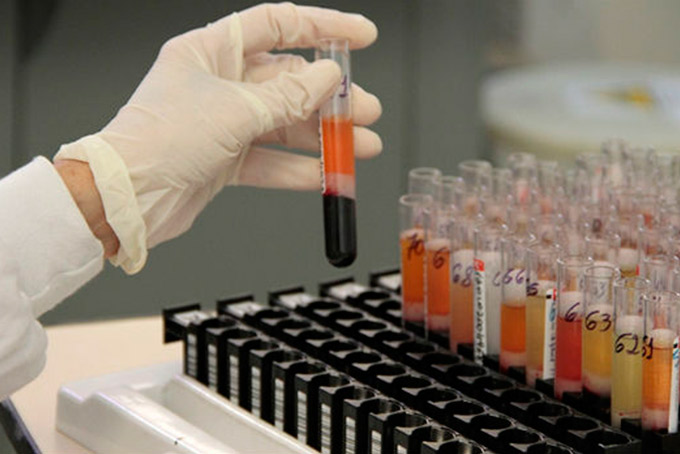Pesquisa comprova que vírus da Zika mata células cancerígenas