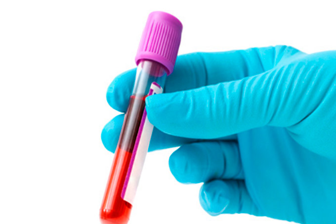 Novo exame de sangue é capaz de detectar oito tipos de câncer