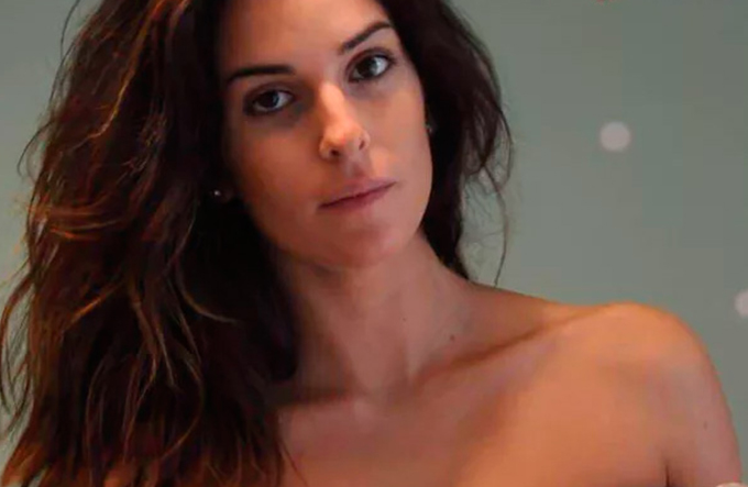 Ex-miss atacada com ácido retorna às passarelas na Itália