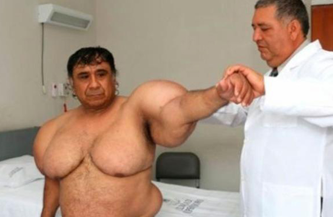 Em caso raro, corpo de mergulhador inchado de forma inexplicável