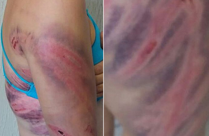 Mulher é agredida pelo marido com mangueira de gás 