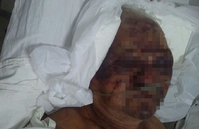 Idoso de 80 anos é internado em estado grave após levar pedradas 