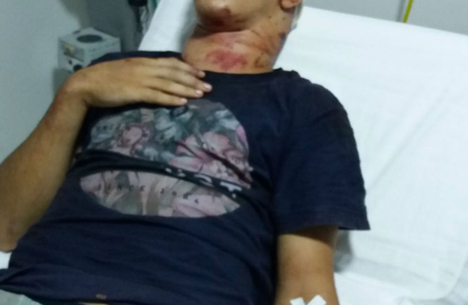 Jovem é torturado e amarrado em árvore durante assalto