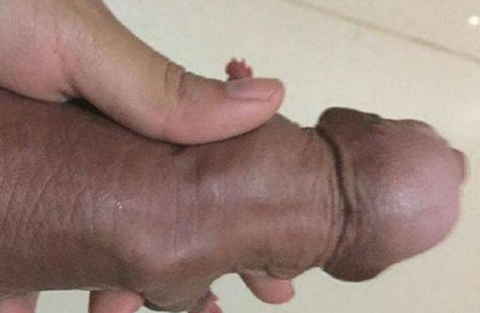 Facebook censura foto de filhote da raça xoloitzcuintle
