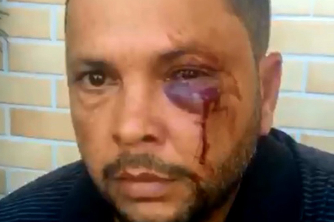 Motorista do Uber denuncia ter sido agredido por três taxistas