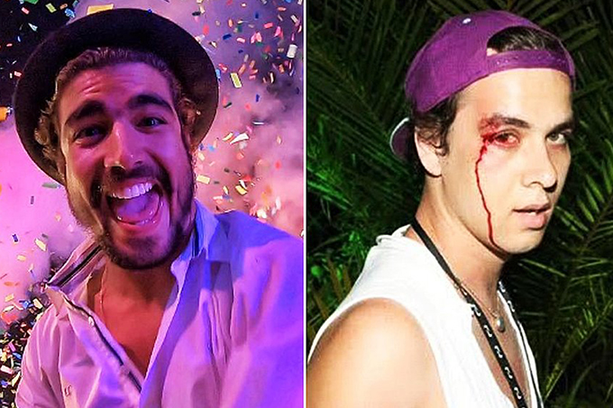 Caio Castro é condenado por agredir fotógrafo na Bahia