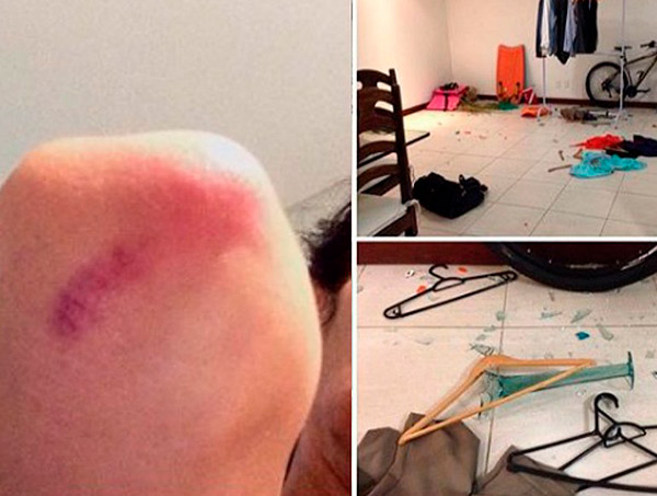 'Ele jogou whisky em meu cabelo e ameaçou atear fogo', diz designer vítima de agressão