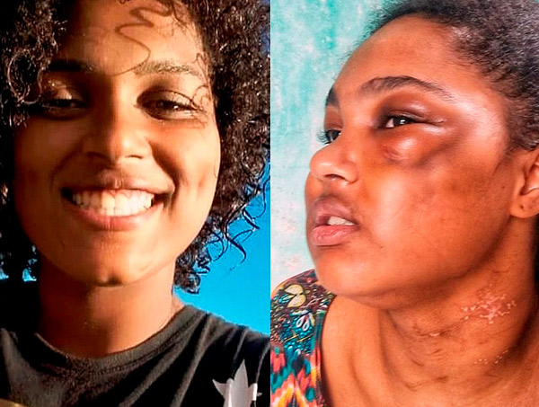 Com medo de suspeito, estudante agredida em Camaçari sai da casa da avó