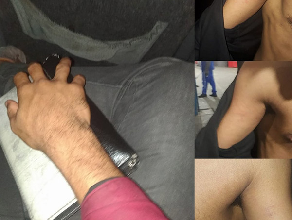 Universitário é agredido por vigilantes na Rodoviária de Salvador