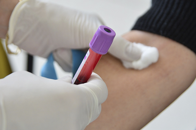 Número de pacientes com hepatite cai 7% em 10 anos no Brasil