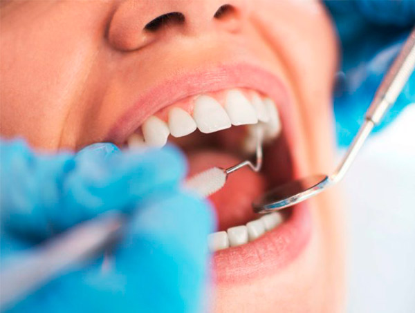 Prefeitura realiza entrega de próteses dentárias para pacientes de Dias d’Ávila