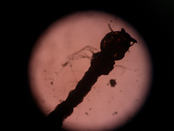 Pesquisa: vírus Zika traz prejuízos motores e de memória a adultos