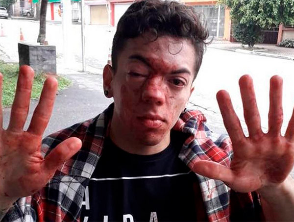 Jovem acusa motorista de ônibus por homofobia na zona leste de SP