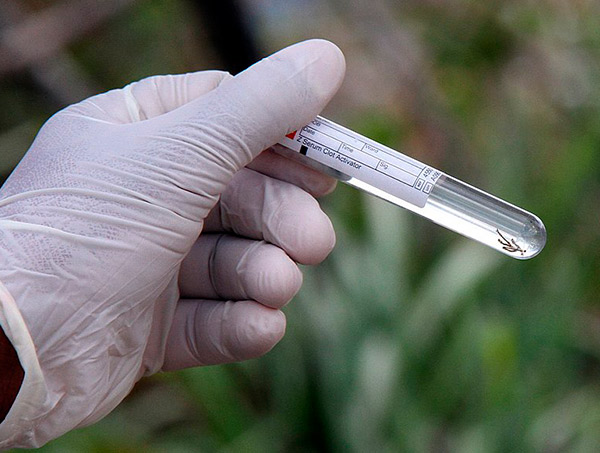 Ministro da Saúde diz que preocupação com dengue é maior na Bahia