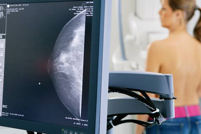 Hospital municipal realiza exames de mamografia sem agendamentos