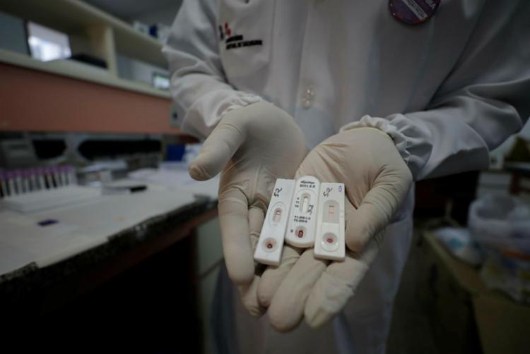 Pesquisadores descrevem novo subtipo do HIV