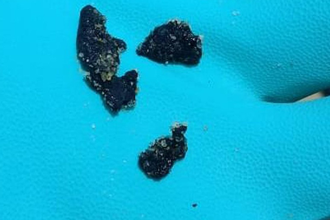 Fragmentos de óleo chegam em praia do Rio de Janeiro