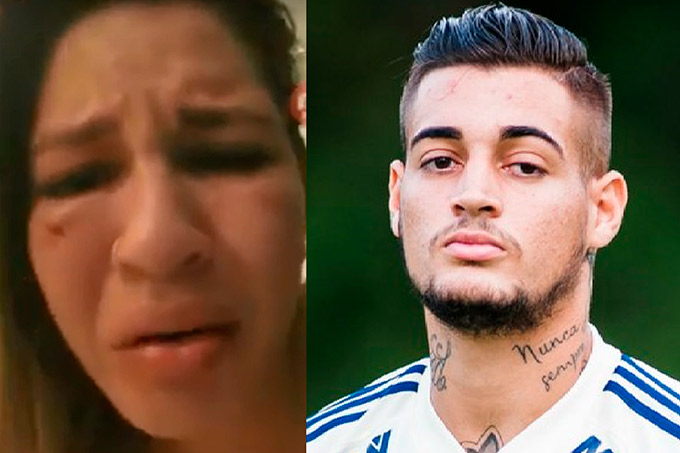 Com olho inchado, esposa de goleiro ex-Bahia denuncia agressões 