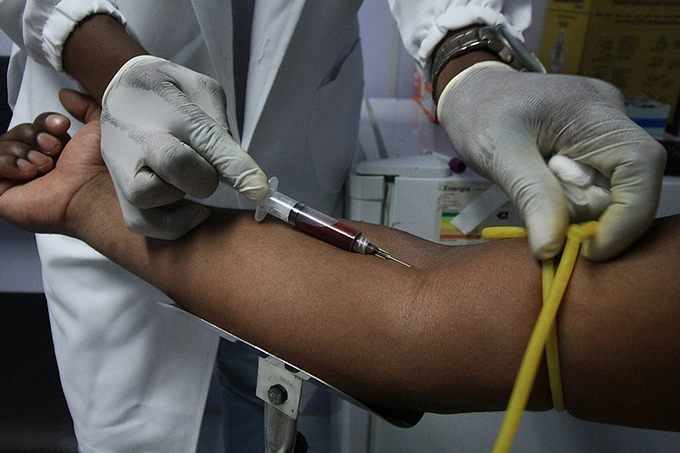 Teste rápido de HIV detecta 10 casos positivos